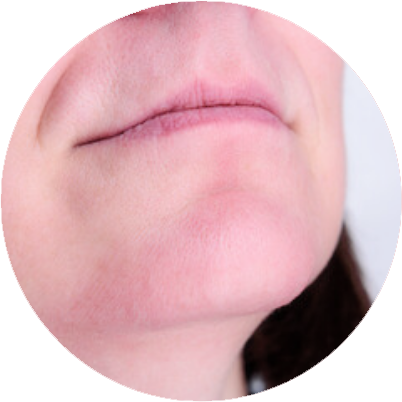 traintement thermolyse sopk