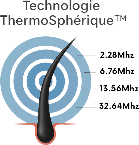 Machine de thermolyse multifréquence 32 MHz