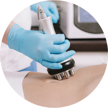 Cavitation Treatment