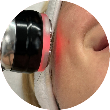 Formation Anti-&Acirc;ge Treatment