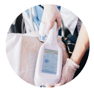 Séances cryolipolyse