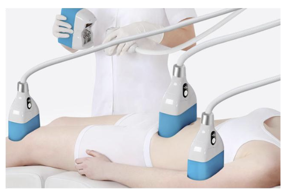 Intégration cryolipolyse