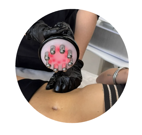 Zones traitement radiofr&eacute;quence